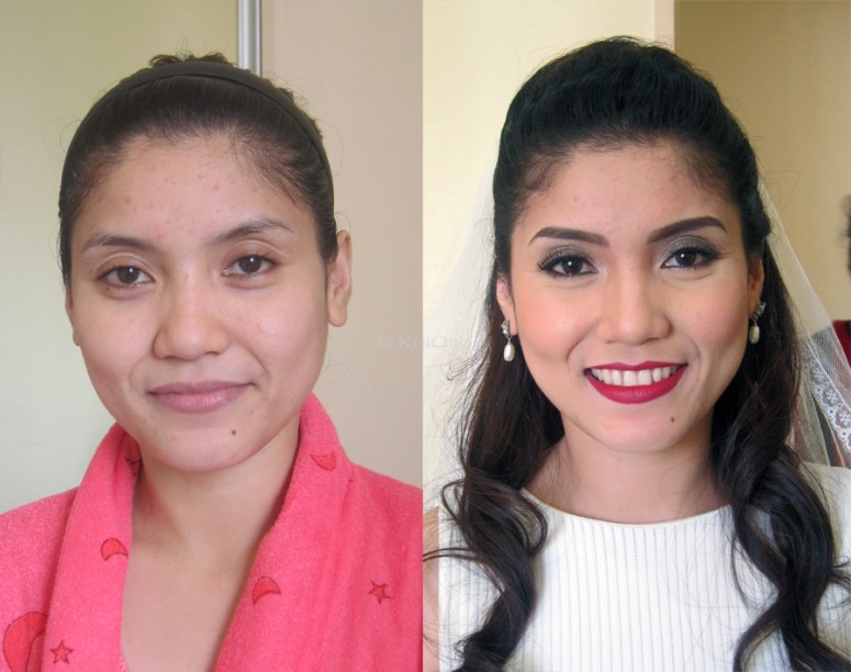 before-and-after-anj