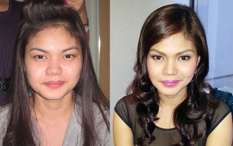 1chin-before-and-after