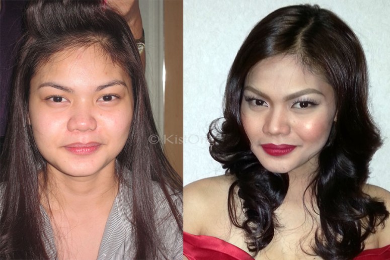 2chin-before-and-after