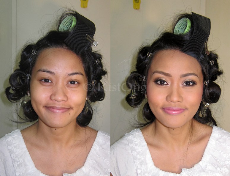 3rara-before-after