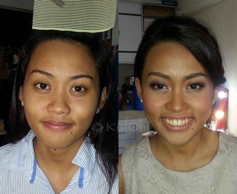 rara-before-after